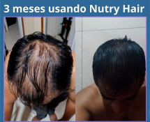 3 meses usando Nutry Hair (3)