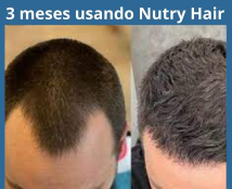 6 meses usando Nutry Hair (1)